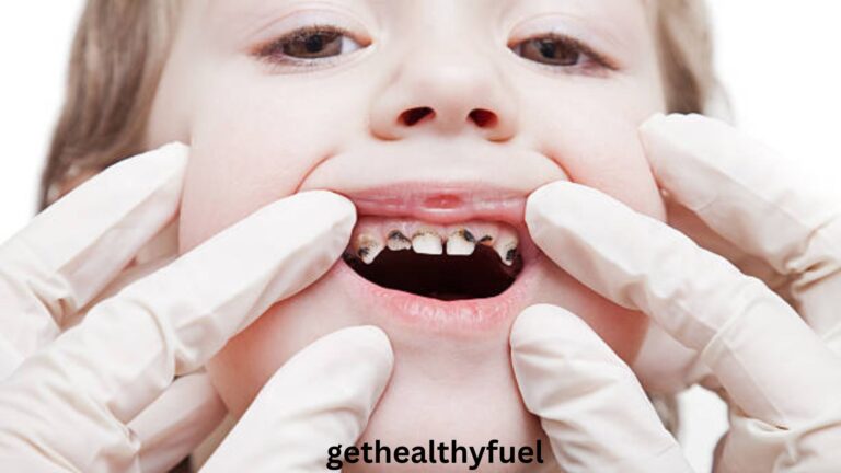 reverse tooth decay