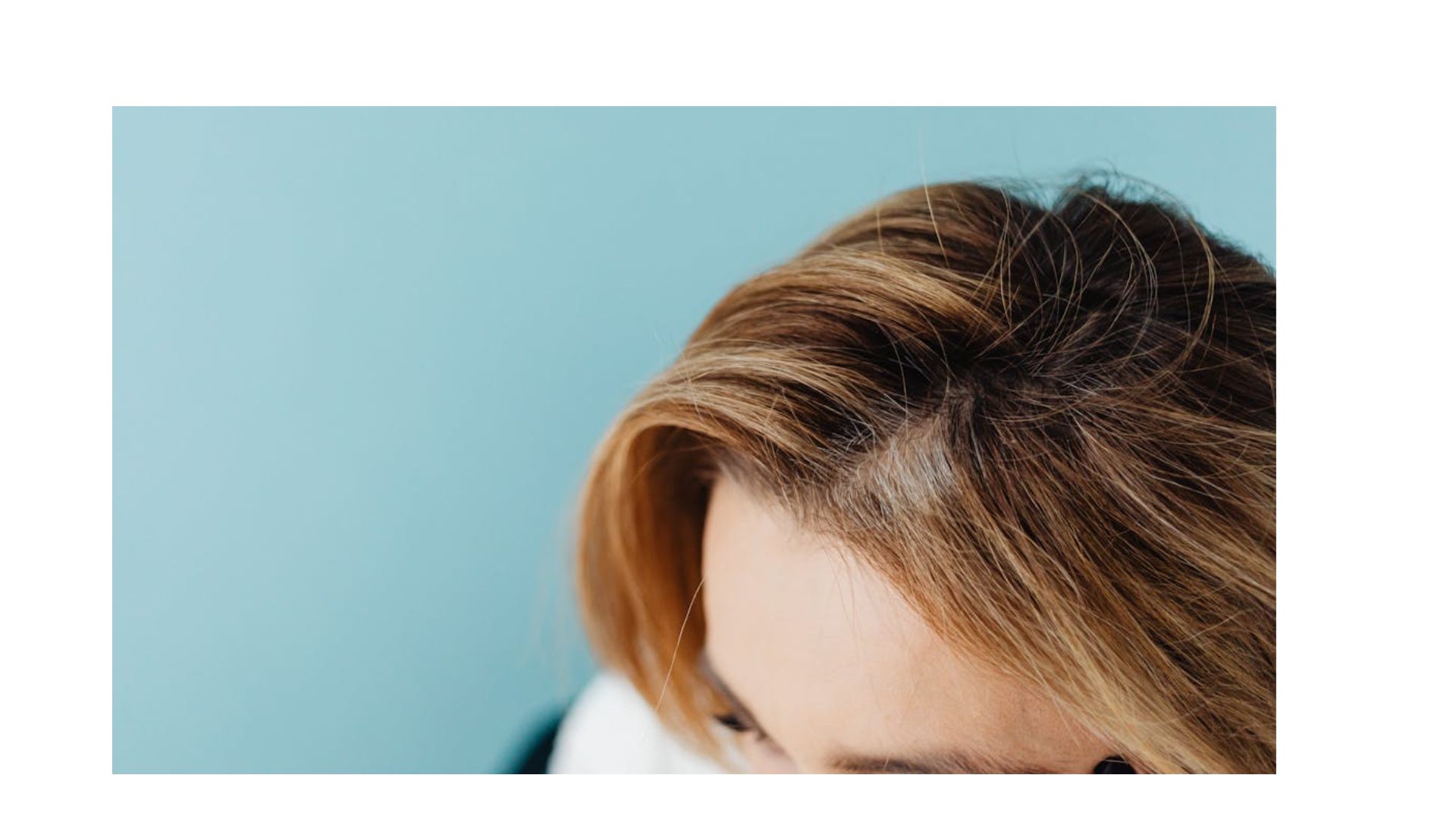 hair loses in mem and women